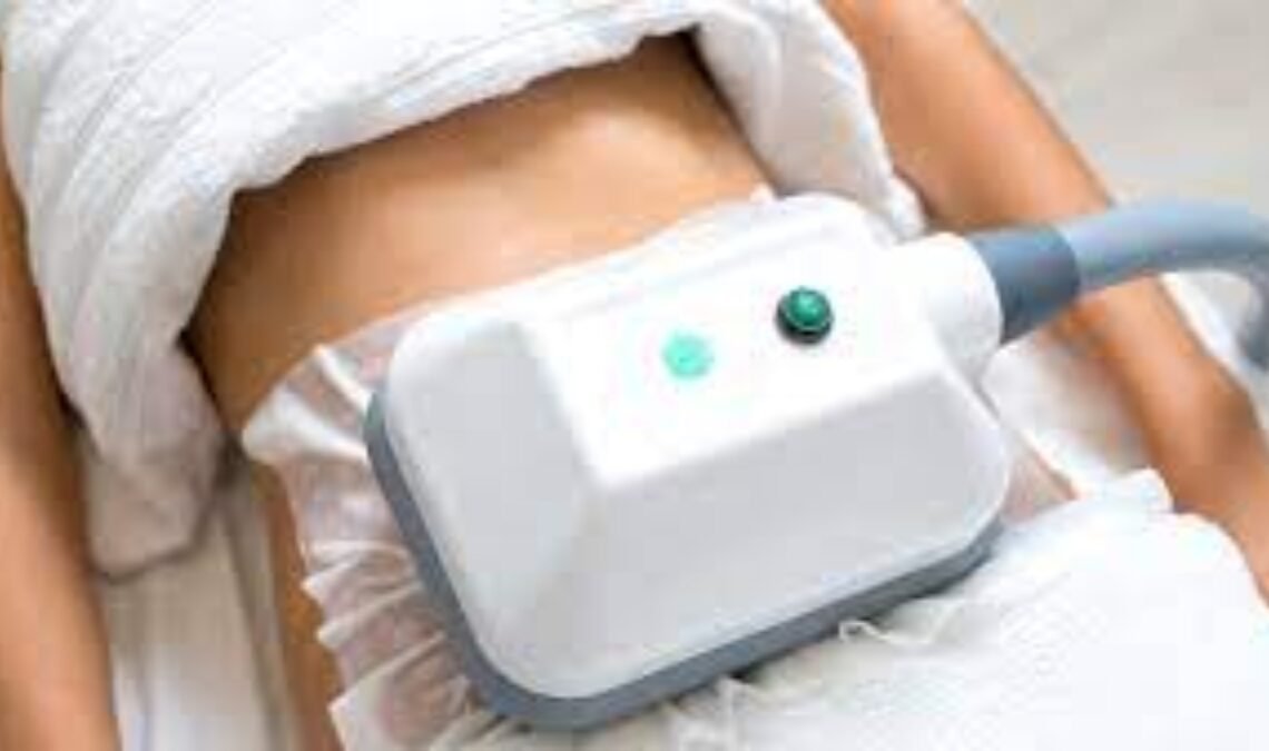 Coolsculpting